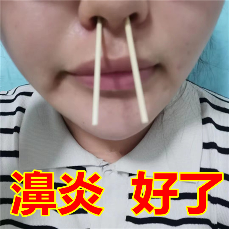 李氏鼻炎儿童棒鼻甲肥大药根治粉