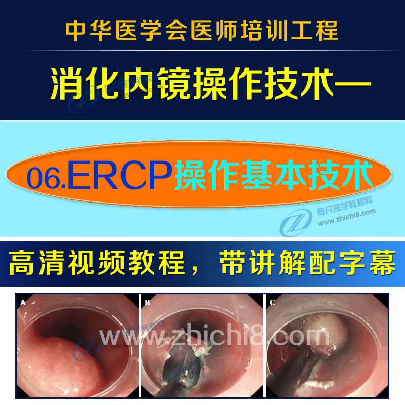 06.ERCP操作基本技术高清视频消化内镜操作技术系列ercp视频课程