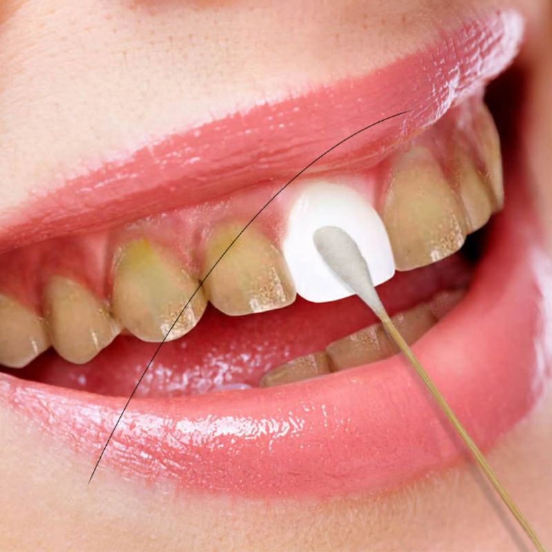 萱晴牙齿洁净提亮笔牙膜贴美白去黄非速效神器碧提福美牙仪凝胶缇- 优