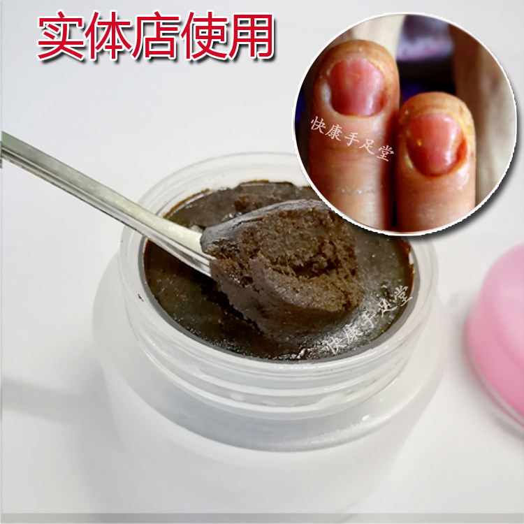 脱甲膏脚指甲软甲膏软化指甲生长液长甲膏嵌甲无痛脱甲精油灰甲清