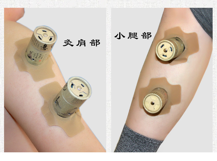 百岁灸圣透仲智灸艾灸装置百灸罐筒笑御能灸御能灸儿童悬磁笑凤保