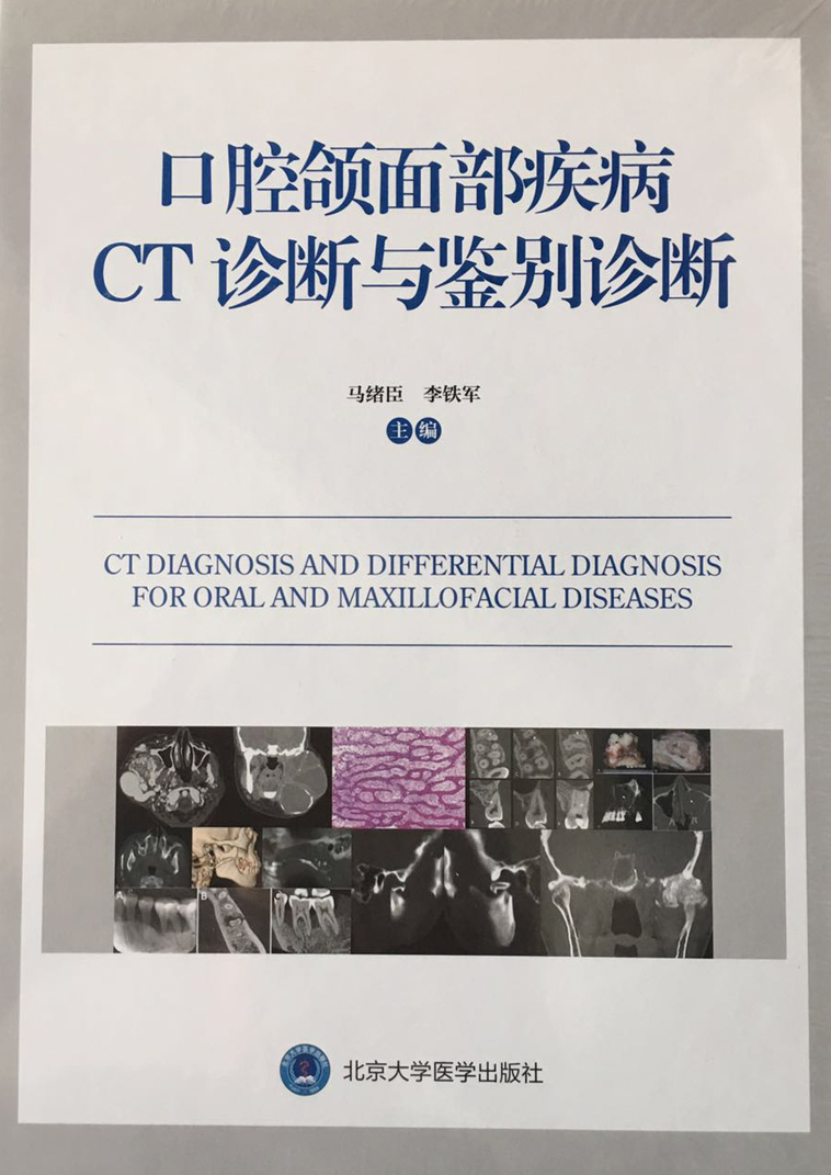 S口腔额面部疾病 CT诊断与鉴别诊