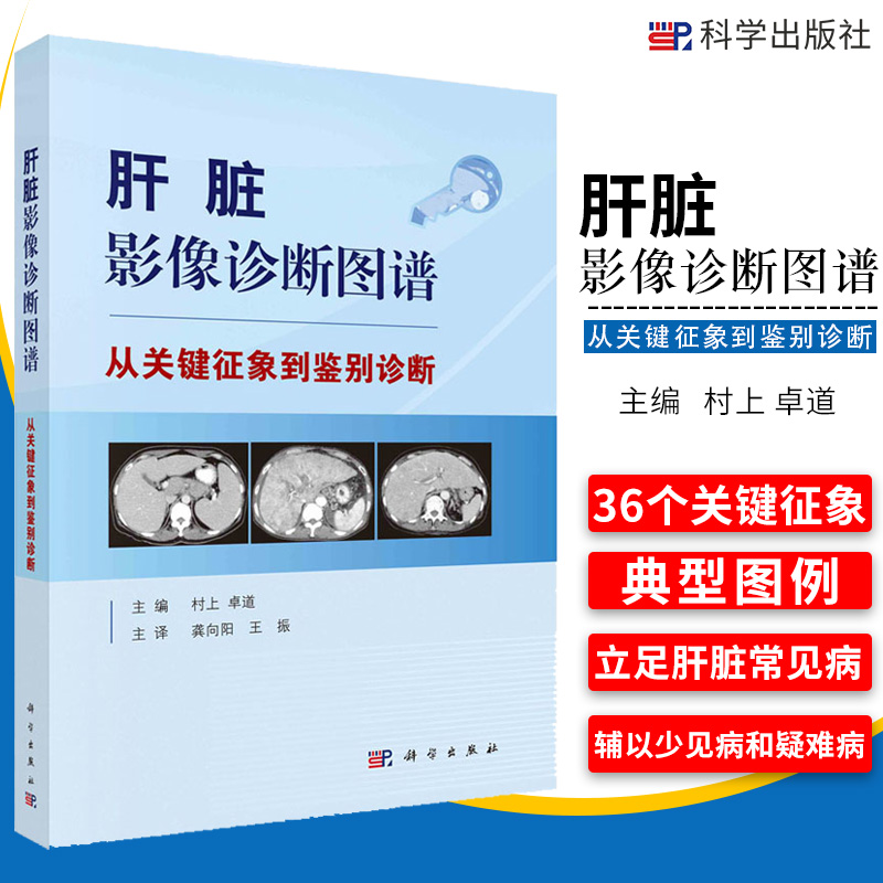 肝脏影像诊断图谱 从关键征象到鉴别