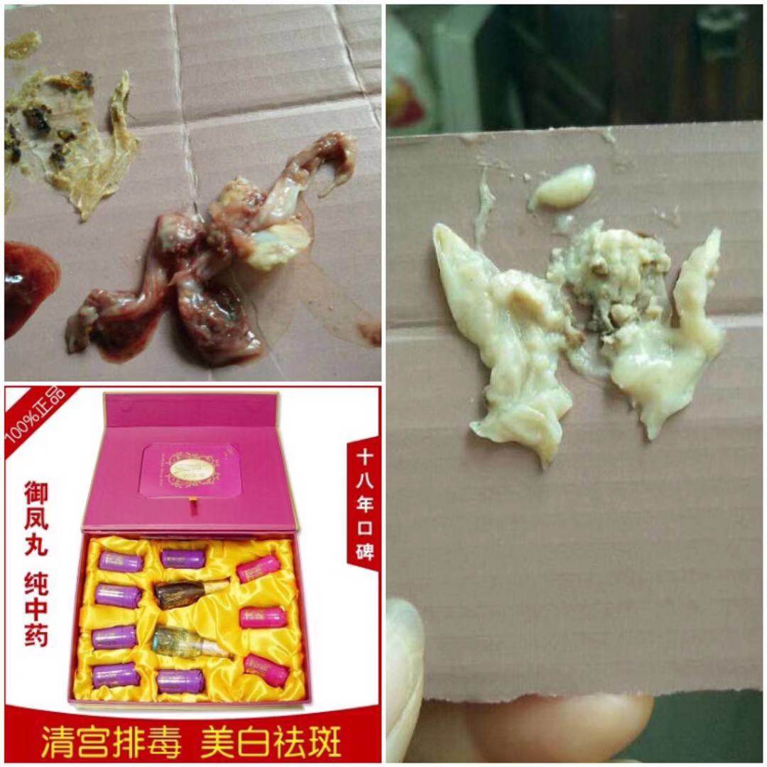正品康丽人生御贵人御凤丸清宫排毒530包邮买一盒9颗装送3颗装