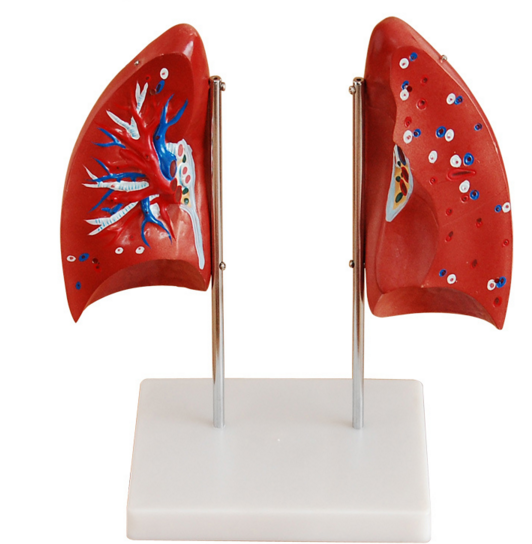 肺解剖模型 人体医学解剖模型 肺部教学培训专用模型