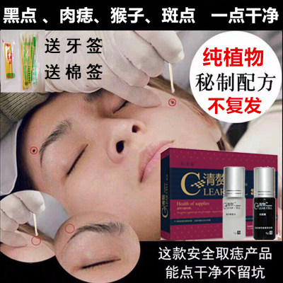 清赘去痣点痣药水无痕正品祛痣神器祛痣膏修复液取痣去志痦子肉痣