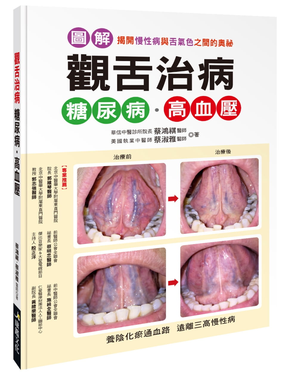 【预售】台版 观舌治病糖尿病 高血