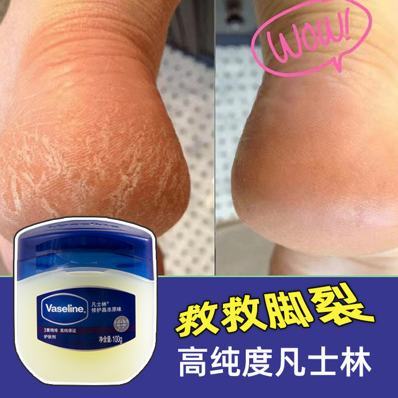 凡士林脚后跟干裂修复霜神器治脚裂脱皮防足裂龟裂脚裂膏护足霜