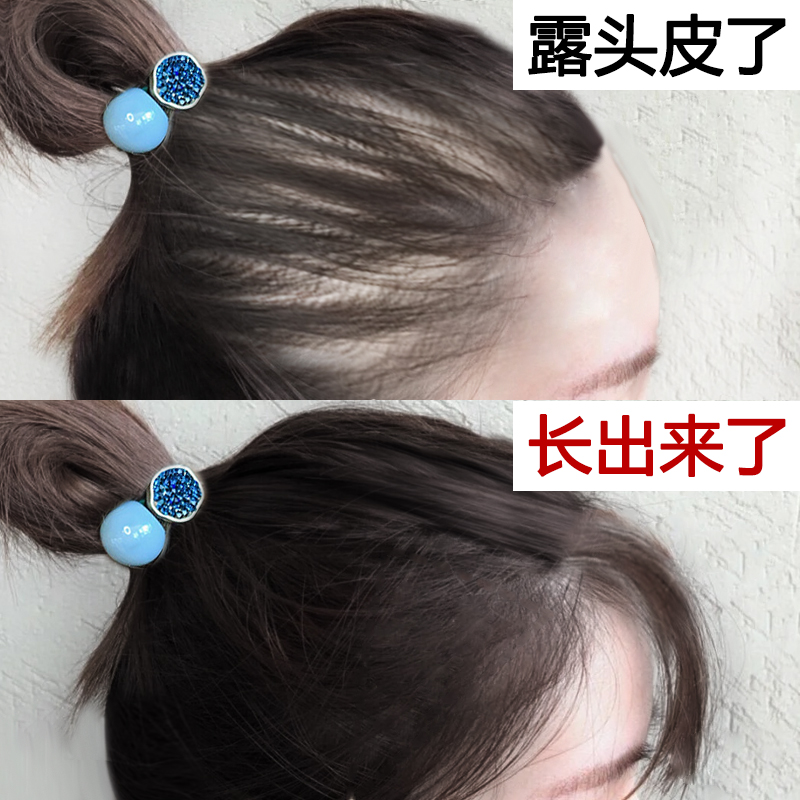 【李佳琪推荐 仁和育发液】头发自然生长速度 变密变多变长在类目 洗护清洁剂/卫生巾/纸/香薰, 洗发沐浴/个人清洁, 头发清洁/护理/造型, 洗发水中 - 来自Buy2taobao.com提供专业的淘宝代购服务