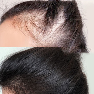 【金星推荐洗发水】仁和育发液 头发自然茂密 男女通 买4送2