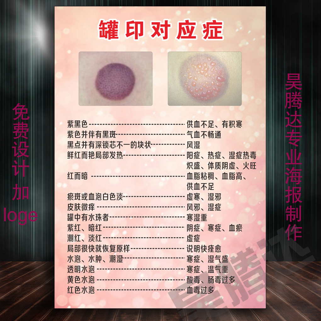 罐印对应症状 中医面部美容养生spa医疗保健挂图宣传画海报657