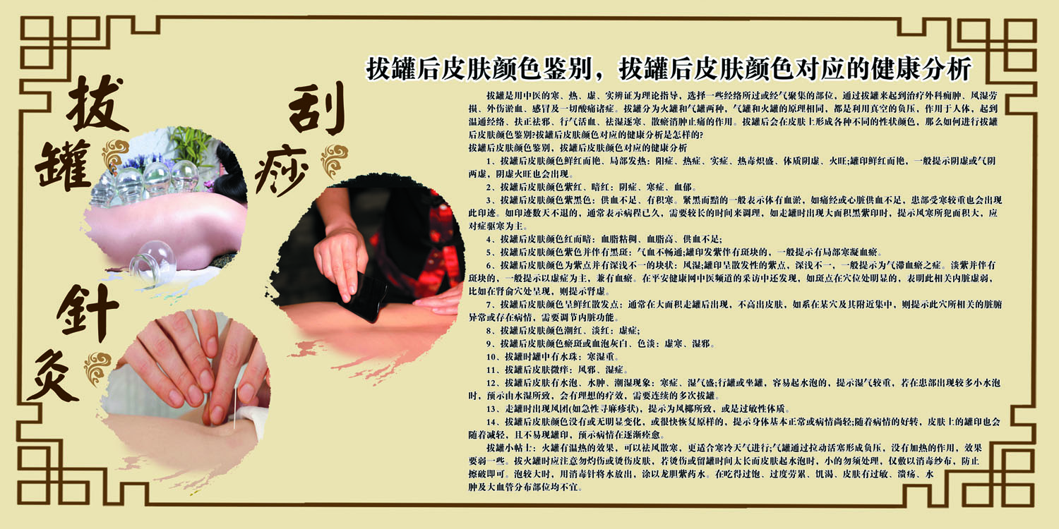 海报印制展板写真喷绘拔罐皮肤颜色鉴别对应写真