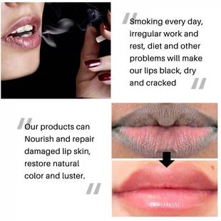 推荐Lip Black Removal Lip Balm Exfoliating Fade Black Lip Ca