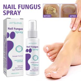 极速100ml Effective Anti-Fungal Feet Infections Athlete Foot