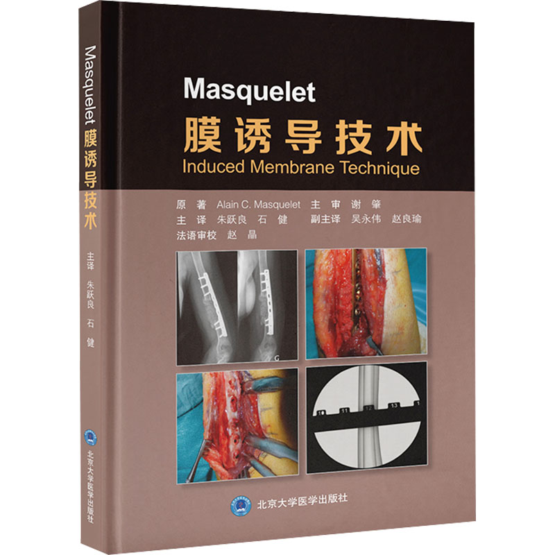 【新华文轩】Masquelet膜诱