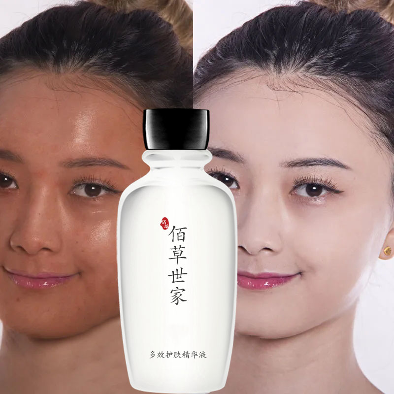 佰草世家去黄气提亮肤色美白精华液脸色暗黄改善发黄去暗沉护肤品