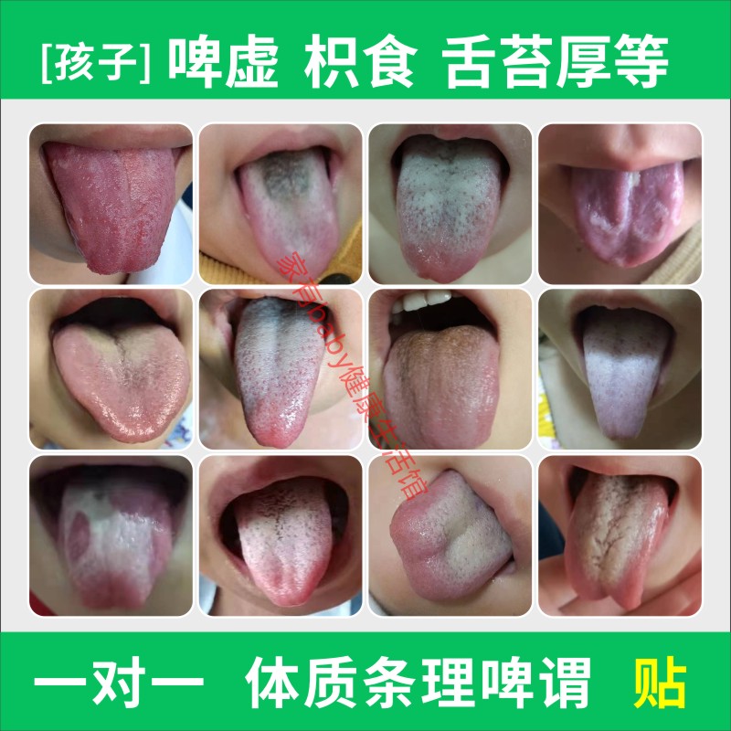 宝宝调理脾胃中药保健贴儿童舌苔厚地图舌口臭胀气小儿健脾消积食