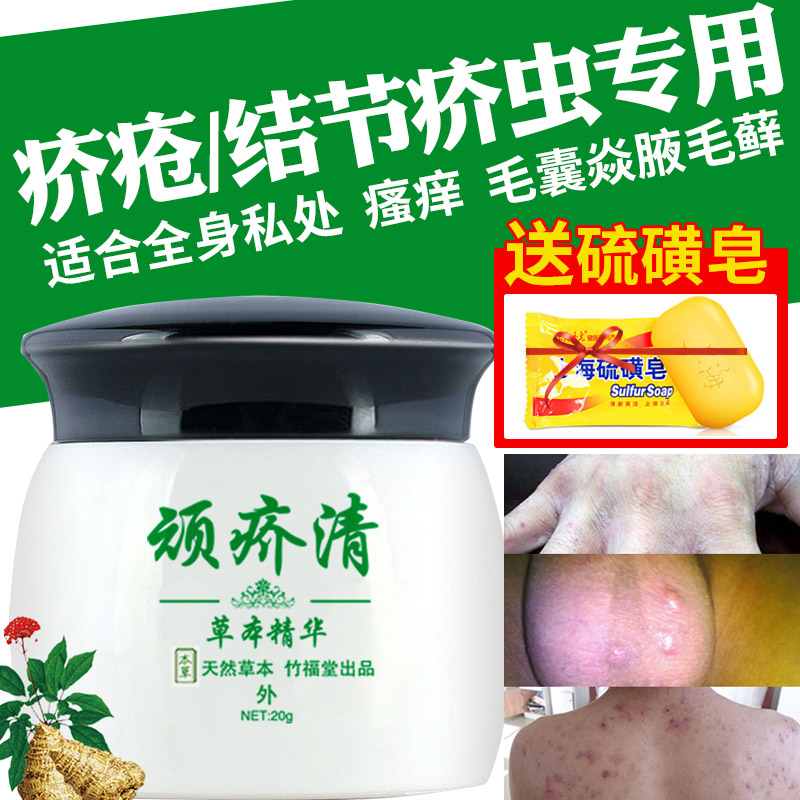 硫磺软膏乳疥疮结节疥虱康宁疥灵霜阴囊疥虫皮肤瘙痒一扫光正品