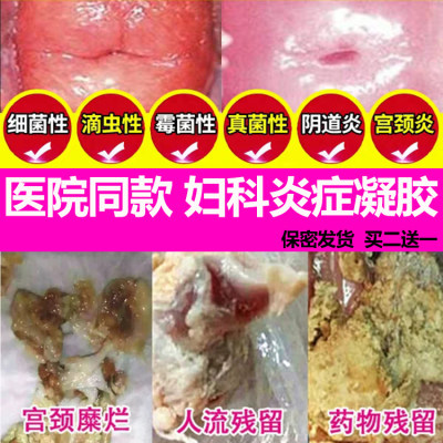 一折妇科炎症凝胶正品