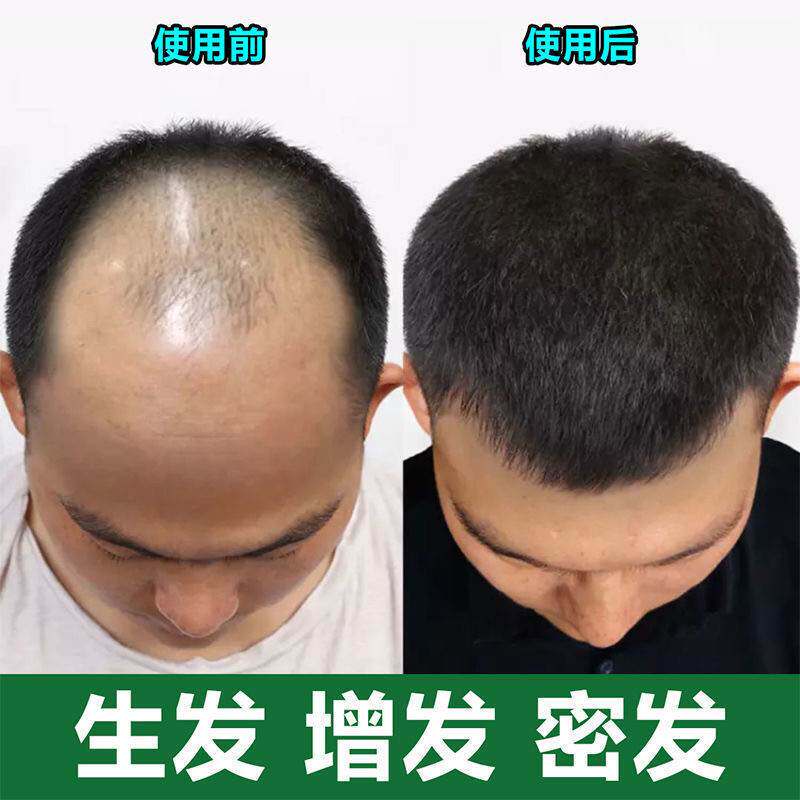 佳肤育发液妮洗发水愈发液苏佑和荷堂生发液育发佳肤育发液乌发妮