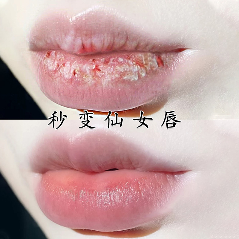 【小红书达人推荐】丰唇精油神器薄嘴唇变厚 丰出嘟嘟唇 拍一发三|msdalam kategori Alat solek/minyak wangi/kecantikan, Alat-alat Kecantikan, Makeup/Alat kecantikan - dari Buy2taobao.com untuk memberikan perkhidmatan ejen Taobao profesional membeli