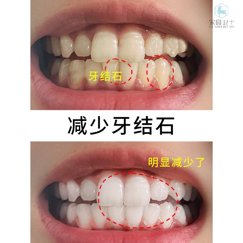 搜索"去除牙结石牙膏"的优惠券结果页-搜券网