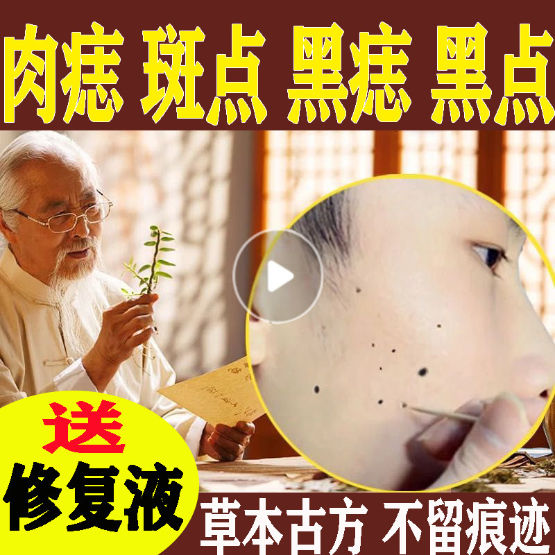 点痣专用药