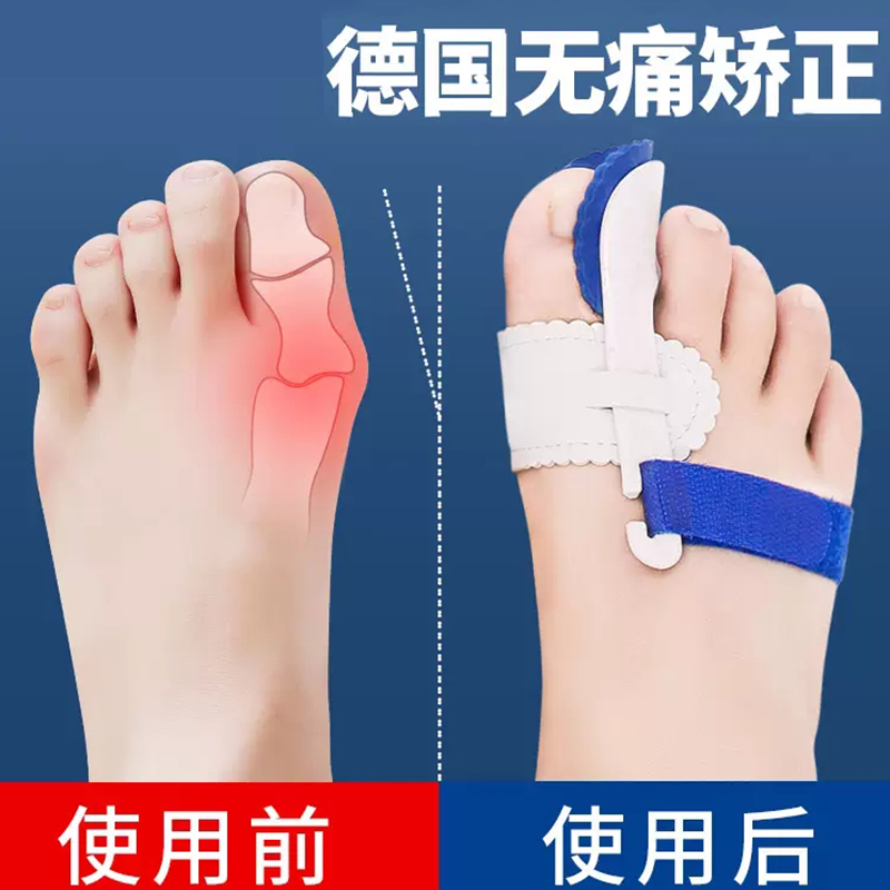 ㊙️【改变丑脚骨 变仙女脚】大山式脚趾环腿部矫正器|msdalam kategori Penjagaan diri/kesihatan/peralatan urut, Slimming, bekalan postur - dari Buy2taobao.com untuk memberikan perkhidmatan ejen Taobao profesional membeli