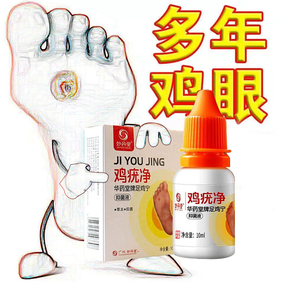 鸡眼药肉刺窝贴瘊子帖挤眼膏上脚底趾疣老茧去除鸡尤平尤净鸡茧已售41