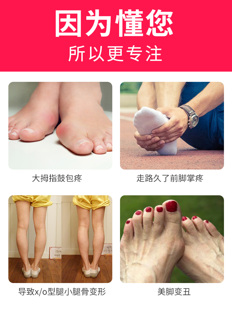 大母脚趾头矫正器拇指内外翻姆大脚拐骨脚型分趾男女士可以穿鞋反