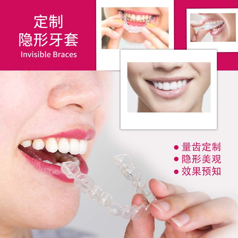 成人牙套隐形龅牙牙外缝隙大地包天透明牙齿矫正器 原价280元 现价60