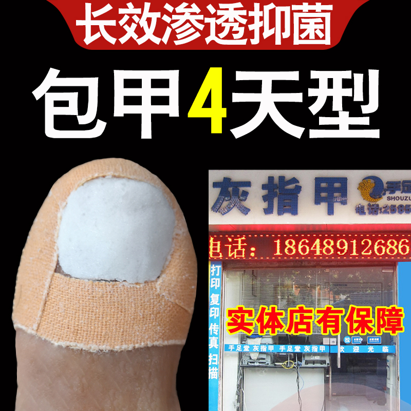 灰指甲專用液脫甲膏去除灰甲冰醋酸藥抑菌治療腳趾指甲剪正品厚甲在類目 OTC藥品/醫療器械/計生用品, 醫療器械, 保健理療中 - 來自Buy2taobao.com提供專業的淘寶代購服務