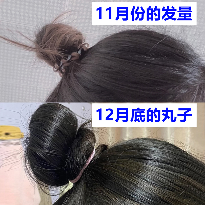 Weiya viya Studio Drugs are Renhe Sterile liquid Hair natural Grow Speed changeablein the Care cleaners/Sanitary napkins/Paper/Aromatherapy , Personal care service, Hair salon service category - from Buy2taobao.com to provide professional Taobao agent buy service