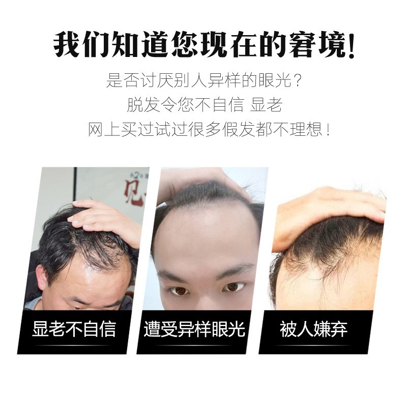 高档发际线男假发贴男士前额无痕可修剪发型真人发丝隐形M型额头