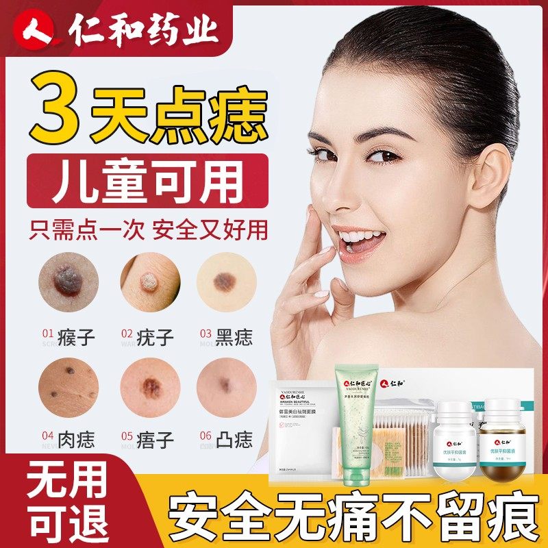 点痣膏无痕正品