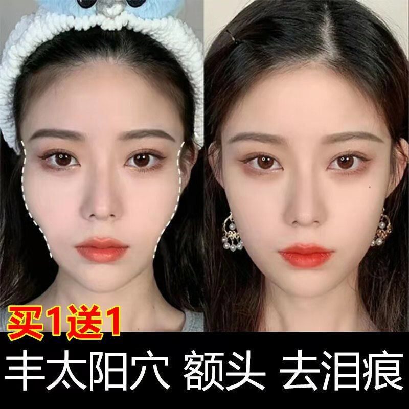 丰太阳穴额头脸颊凹陷