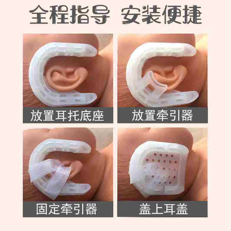 婴儿耳朵矫正器宝宝耳廓纠正器新生儿畸形矫形招风耳垂耳塑形定型