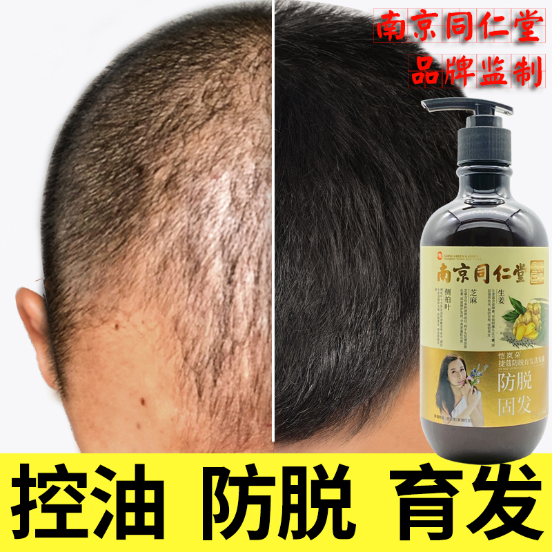石上百汀防脱苗赛馥洗发水绿江南水本草专健发植滋养防脱洗发水