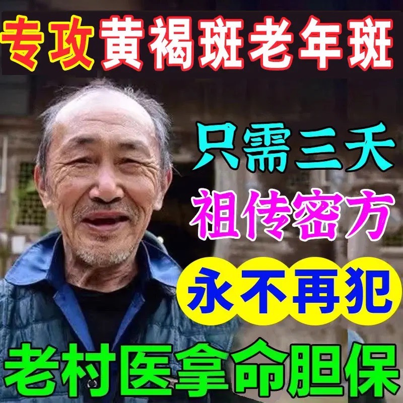 老年斑强力去除手部脸部去斑专用老人祛斑霜祛黄褐斑雀斑官方正品