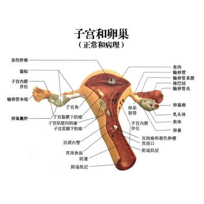 模型演示病理模具模型模型阴道教学子宫女性子宫人体卵巢模型生殖