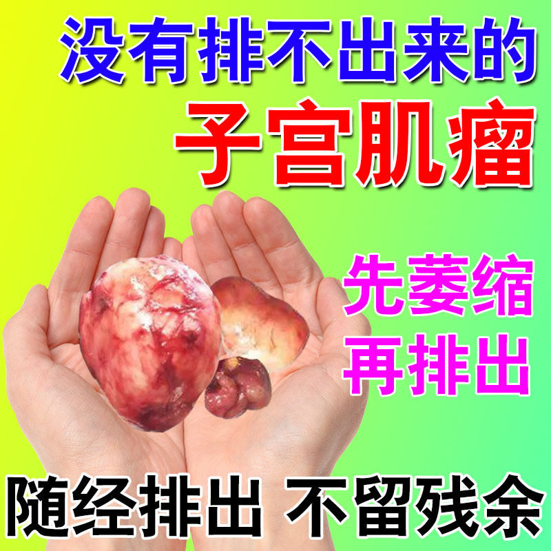 子宫肌瘤卵巢囊肿腺肌症调理痛经白带