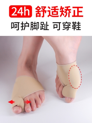 大母脚趾头矫w正器拇指内外翻姆大脚拐骨脚型分趾男女士可以穿鞋