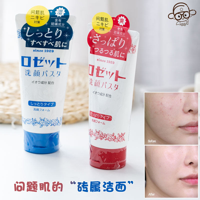 硫磺祛痘洗面奶深层清洁控油洁面男式去黑头角质