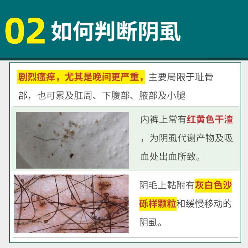 特价去虱_去除虱子药儿童一扫光大人用小女孩头发的百部酊灭阴虱喷剂