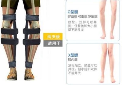 内八字矫正器儿童夜用矫正腿型神器夹板腿型矫正神器直腿夜用八