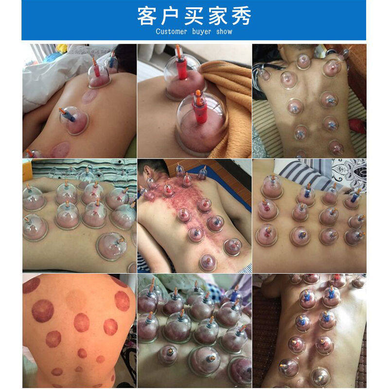 拔罐器家用抽气式24