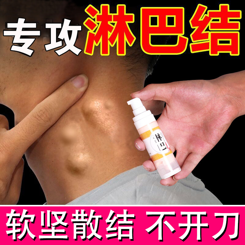 淋巴结肿大散结贴膏【不消白送】专消颈部腋下淋巴结节肿大疼痛cy