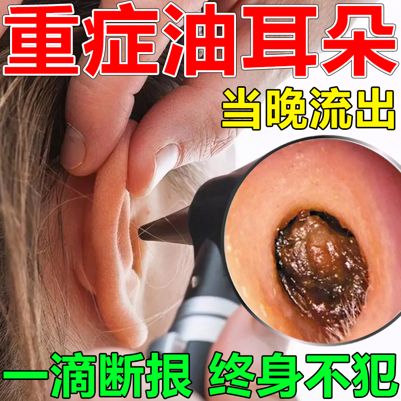 油耳朵清洁器滴耳液儿童油耳朵治疗神器去油清理耳痒耵聍克星专用