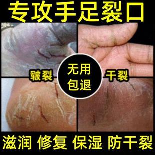 专治手裂的药膏防皲裂防裂膏凡士林手指脚后跟裂口干燥脱皮修复霜
