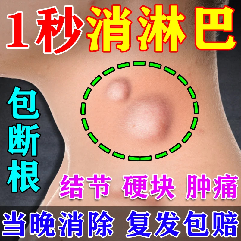 治疗膏颈部副乳耳后疏通神器肿大散结专用膏贴药膏腋下